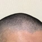 1年間坊主にしてみて分かったメリット・デメリット